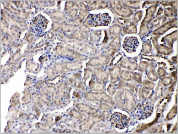 product-image-AAA11680_IHC2.jpg
