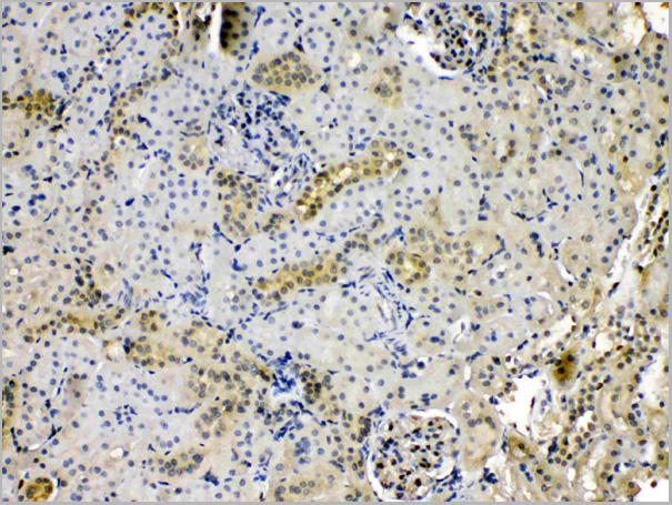 product-image-AAA11680_IHC3.jpg