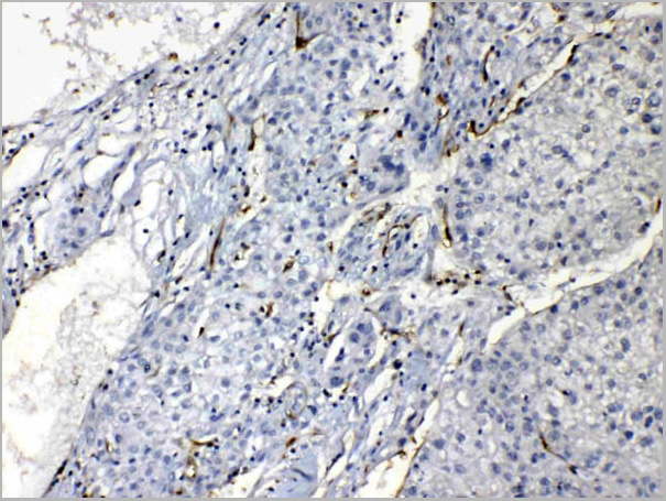 product-image-AAA11680_IHC4.jpg
