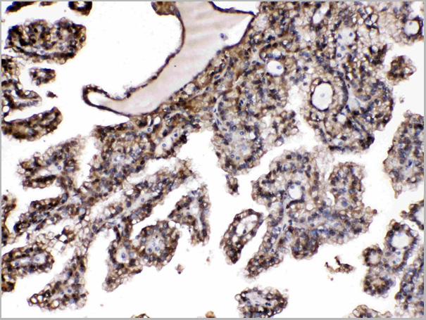 product-image-AAA11680_IHC5.jpg