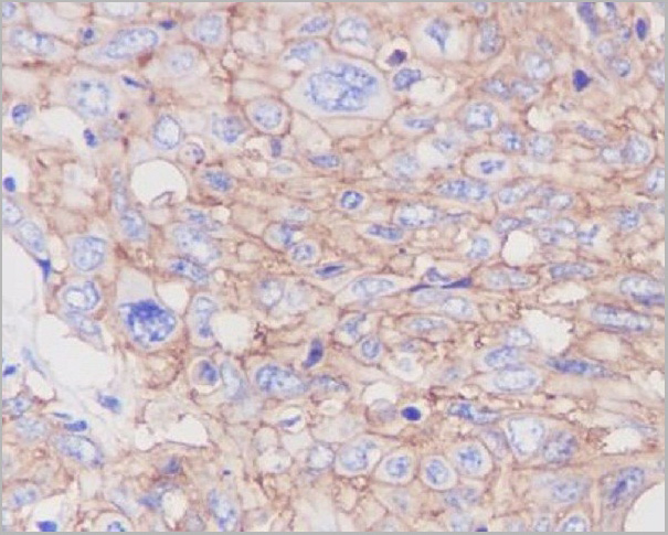product-image-AAA11692_IHC.jpg