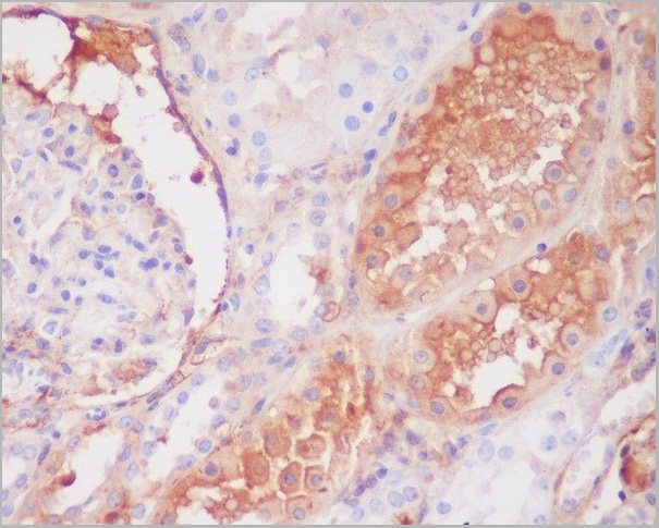 product-image-AAA11695_IHC.jpg