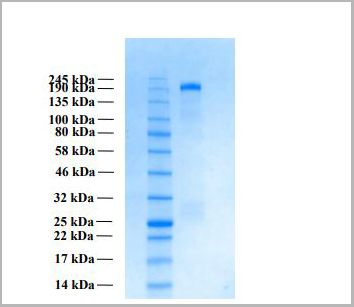 product-image-AAA11699_SDS_PAGE.jpg