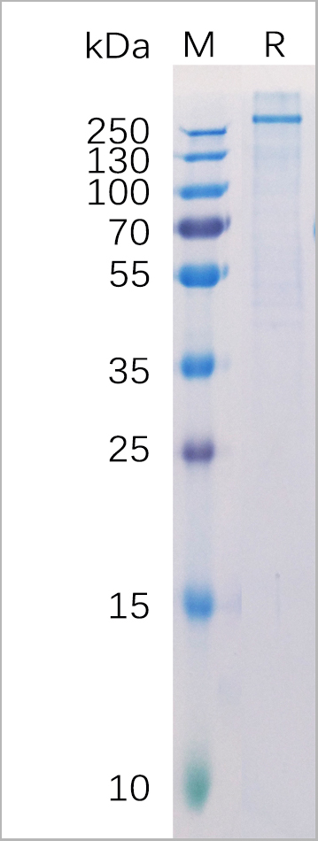 product-image-AAA11708_SDS_PAGE.jpg