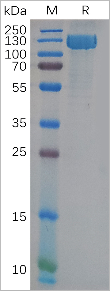product-image-AAA11709_SDS_PAGE.jpg