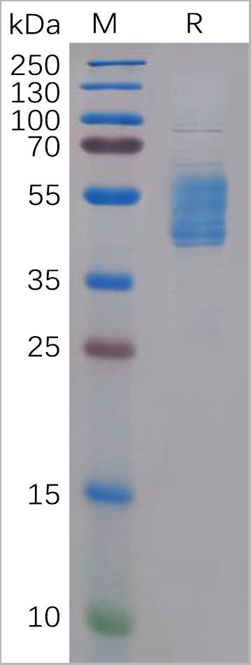 product-image-AAA11711_SDS_PAGE2.jpg