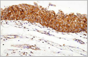 product-image-AAA11726_IHC3.jpg