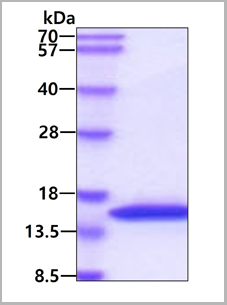 product-image-AAA11736_SDS_PAGE.png