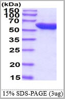 product-image-AAA11737_SDS_PAGE.jpg