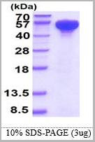 product-image-AAA11739_SDS_PAGE.jpg
