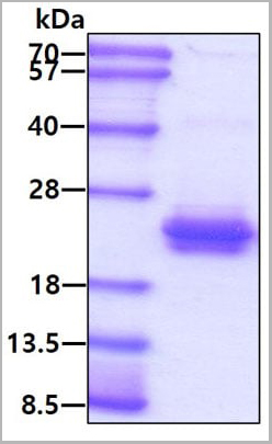 product-image-AAA11741_SDS_PAGE.jpg