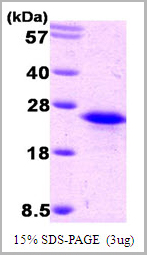 product-image-AAA11745_SDS_PAGE.jpg