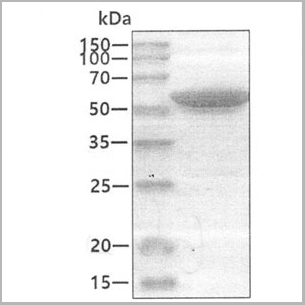 product-image-AAA11746_SDS_PAGE.jpg