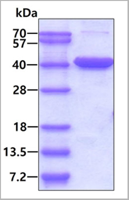 product-image-AAA11750_SDS_PAGE.jpg