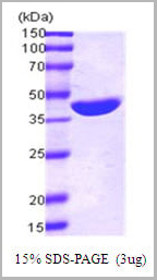 product-image-AAA11752_SDS_PAGE.jpg