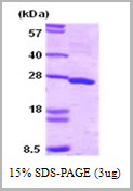product-image-AAA11756_SDS_PAGE.jpg