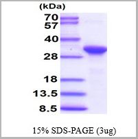 product-image-AAA11759_SDS_PAGE.jpg