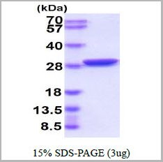 product-image-AAA11761_SDS_PAGE.jpg