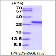 product-image-AAA11767_SDS_PAGE.jpg