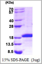 product-image-AAA11769_SDS_PAGE.jpg