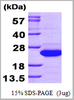 product-image-AAA11770_SDS_PAGE.jpg