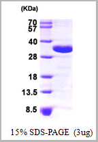 product-image-AAA11771_SDS_PAGE.jpg