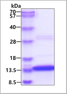 product-image-AAA11772_SDS_PAGE.png