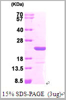 product-image-AAA11773_SDS_PAGE.jpg
