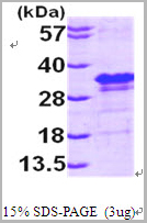product-image-AAA11775_SDS_PAGE.jpg