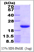 product-image-AAA11776_SDS_PAGE.jpg