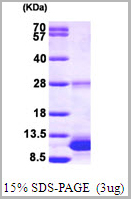 product-image-AAA11777_SDS_PAGE.jpg