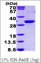 product-image-AAA11778_SDS_PAGE.jpg