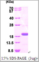 product-image-AAA11786_SDS_PAGE.jpg