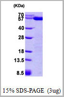 product-image-AAA11788_SDS_PAGE.jpg