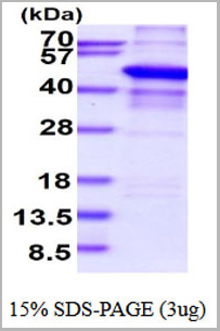 product-image-AAA11789_SDS_PAGE.jpg