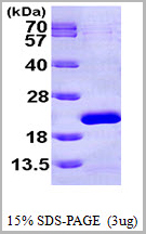 product-image-AAA11795_SDS_PAGE.jpg