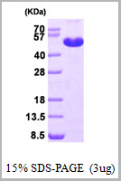 product-image-AAA11796_SDS_PAGE.jpg