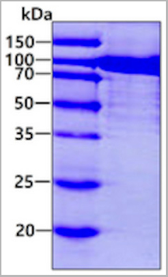 product-image-AAA11797_SDS_PAGE.jpg
