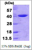 product-image-AAA11802_SDS_PAGE.jpg