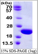 product-image-AAA11809_SDS_PAGE.jpg