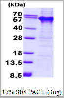 product-image-AAA11810_SDS_PAGE.jpg