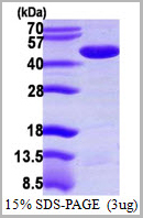 product-image-AAA11812_SDS_PAGE.jpg