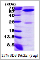 product-image-AAA11816_SDS_PAGE.jpg