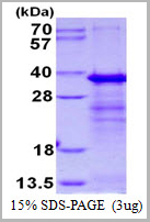 product-image-AAA11817_SDS_PAGE.jpg