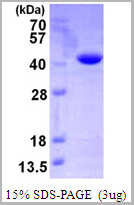 product-image-AAA11823_SDS_PAGE.jpg