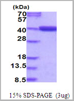 product-image-AAA11827_SDS_PAGE.jpg