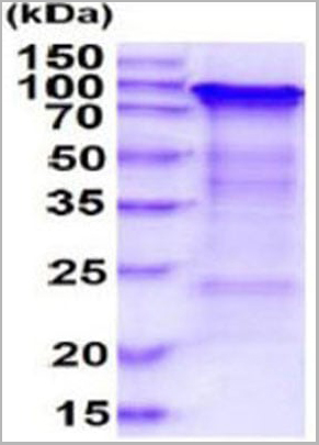 product-image-AAA11828_SDS_PAGE.jpg