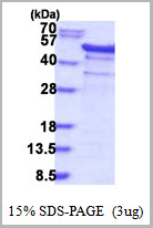 product-image-AAA11830_SDS_PAGE.jpg