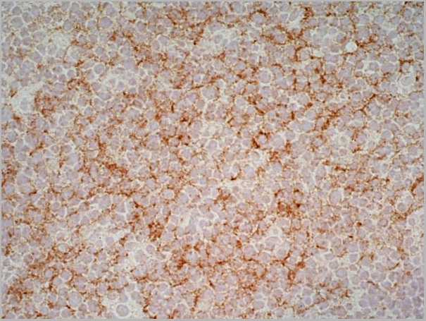product-image-AAA12011_APP4.jpg
