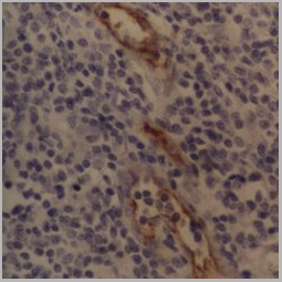 product-image-AAA12247_IHC.jpg